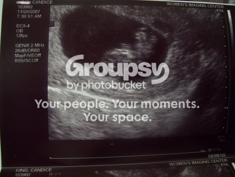 baby1.jpg