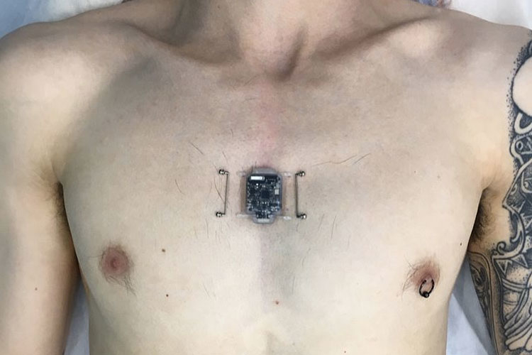 North-Sense-implant.jpg